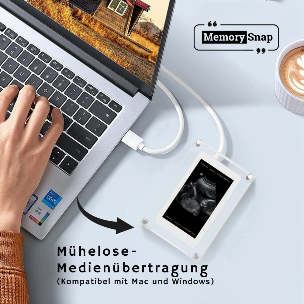 MemorySnap™ Ultraschall Rahmen